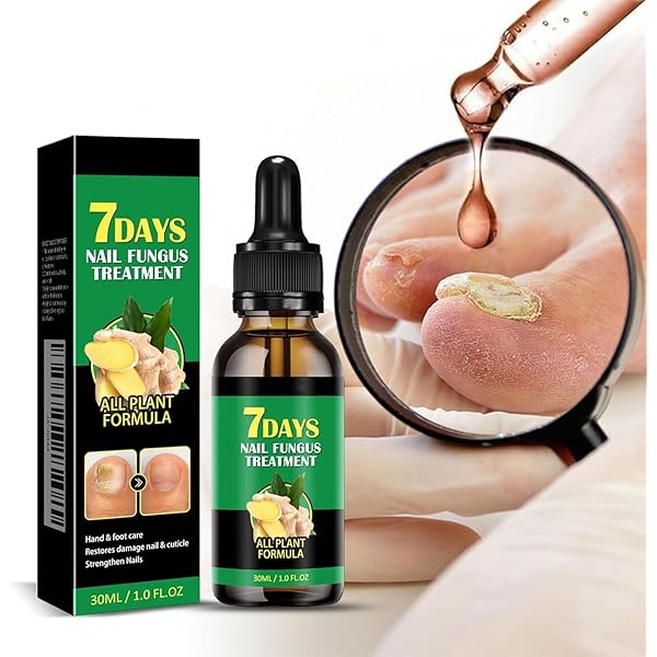 Tratamiento para Hongos en Uñas 7 Days