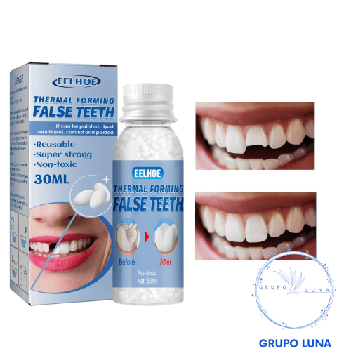 Dientes Temporales - Masilla Moldeable